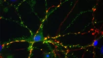 Neurones embryonnaires de rat. Après 14 jours de culture, ils ont été transfectés par un plasmide codant pour la forme sauvage de la sous-unité gamma 2 du récepteur au GABA (GABRG2), un neurotransmetteur impliqué dans l'épilepsie, puis laissé en culture 19 jours supplémentaires avant fixation et marquage par immunofluorescence. Les noyaux cellulaires sont marqués en bleu par le Dapi, Gabrg2 est marqué en vert et les synapses inhibitrices sont repérées en rouge par un anticorps anti GAD6 (GAD65 + GAD67).