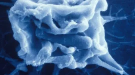 Foyer d'entrée de shigella dans une cellule épithéliale. Cette bactérie envahit et détruit la muqueuse intestinale du côlon provoquant chez l'homme une dysenterie.