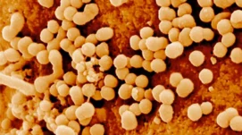 Cellule infectée par le virus de l'immunodéficience humaine (VIH) examinée en microscopie électronique à balayage (MEB)