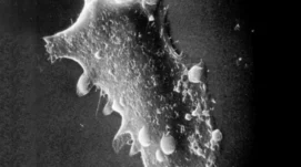 Cellules épithéliales en surface du cristallin humain. Microscopie électronique par balayage (x1200).