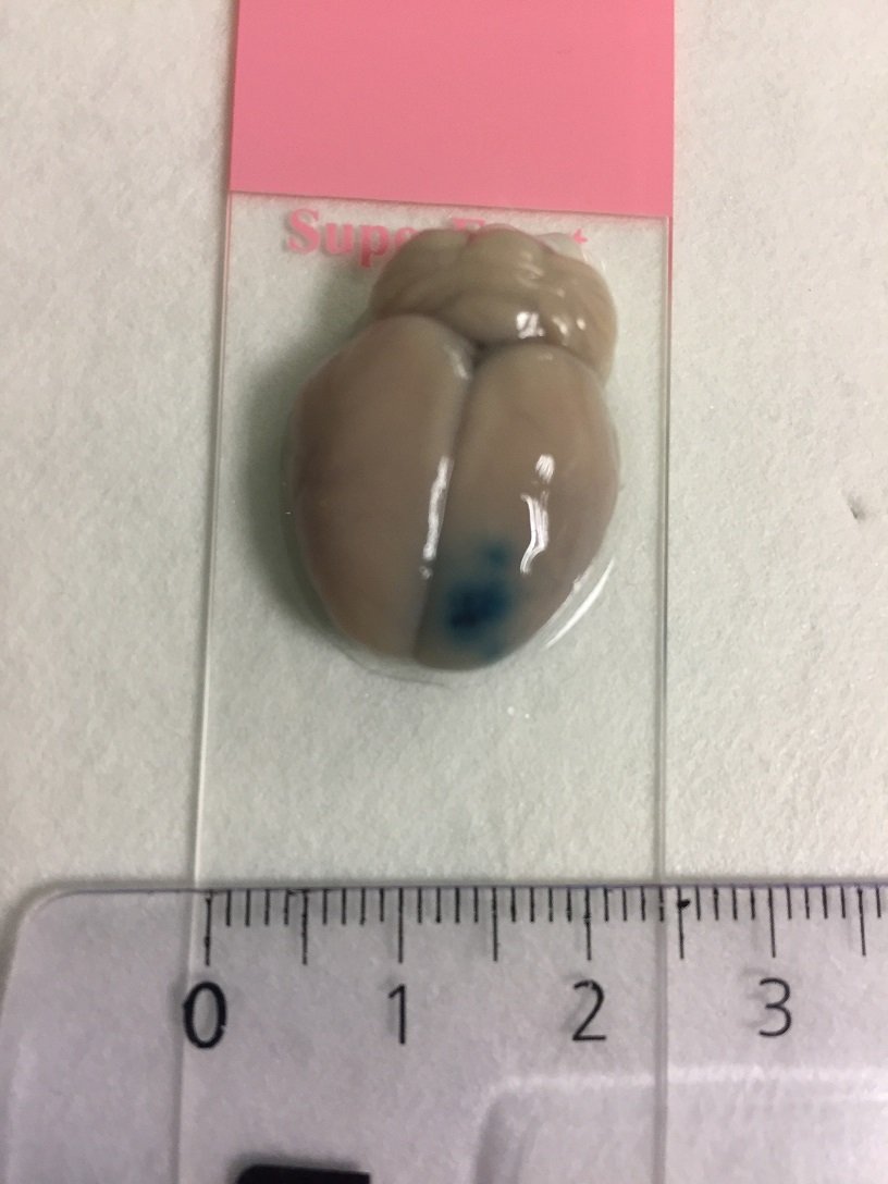 Reportage au laboratoire iBrain, à Tour (unité 1253 Inserm/Université François Rabelais). © Inserm/François Guénet