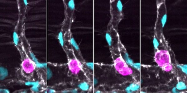 Images obtenues par microscopie confocale © M. Peralta et coll 2025